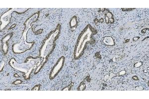 IHC analysis of PARP using anti-PARP antibody (ABIN7602278). (PARP1 抗体  (AA 670-858))