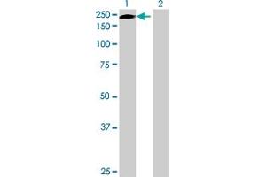 Western Blot analysis of ERCC5 expression in transfected 293T cell line by ERCC5 MaxPab polyclonal antibody. (ERCC5 抗体  (AA 1-1186))