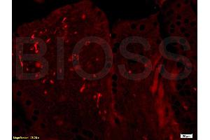 Immunofluorescence (IF) image for anti-BTG Family, Member 2 (BTG2) (AA 31-110) antibody (ABIN723905) (BTG2 抗体  (AA 31-110))