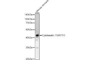 Western blot analysis of extracts of Mouse stomach, using Cytokeratin 17 (KRT17) antibody (ABIN6130112, ABIN6143023, ABIN6143024 and ABIN6213626) at 1:1298 dilution. (KRT17 抗体  (AA 133-432))