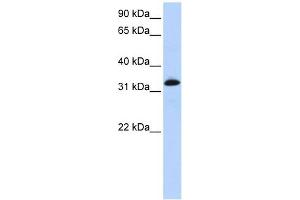 Troponin T Type 2 antibody used at 1 ug/ml to detect target protein. (Cardiac Troponin T2 抗体)