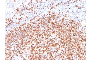 Formalin-fixed, paraffin-embedded human Lymph Node stained with Oct-2 Mouse Monoclonal Antibody (OCT2/2137). (Oct-2 抗体  (AA 112-297))