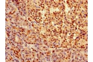 Immunohistochemistry of paraffin-embedded human pancreatic tissue using ABIN7172642 at dilution of 1:100 (SOX9 抗体  (AA 296-501))