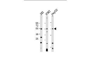 All lanes : Anti-VEGFC Antibody at 1:2000 dilution Lane 1: 293 whole cell lysate Lane 2: K562 whole cell lysate Lane 3: HepG2 whole cell lysate Lysates/proteins at 20 μg per lane. (VEGFC 抗体)