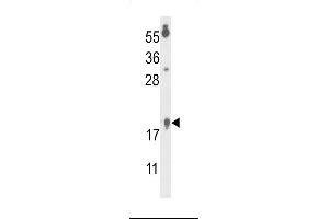 Western blot analysis of FA96B Antibody (N-term) (ABIN653317 and ABIN2842809) in  cell line lysates (35 μg/lane). (FAM96B 抗体  (N-Term))