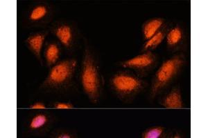 Immunofluorescence analysis of U-2 OS cells using SUPT6H Polyclonal Antibody at dilution of 1:100. (Spt6 抗体)