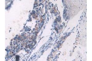 Immunohistochemistry (IHC) image for anti-Procollagen C-Endopeptidase Enhancer (PCOLCE) (AA 315-437) antibody (ABIN7433444)