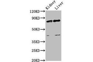 Western Blot Positive WB detected in: Rat kidney tissue, Rat liver tissue All lanes: SUZ12 antibody at 3. (SUZ12 抗体  (AA 131-305))