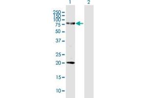 Western Blot analysis of FERMT1 expression in transfected 293T cell line by FERMT1 MaxPab polyclonal antibody. (FERMT1 抗体  (AA 1-677))