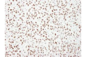 Immunohistochemistry (IHC) image for anti-Minichromosome Maintenance Complex Component 6 (MCM6) (C-Term) antibody (ABIN7448657)