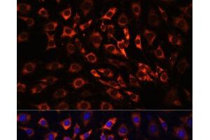 Immunofluorescence analysis of C6 cells using ERK1 / ERK2 Polyclonal Antibody at dilution of 1:100 (40x lens). (ERK1/2 抗体)