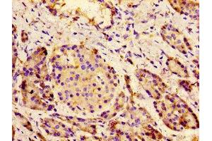 Immunohistochemistry of paraffin-embedded human pancreatic tissue using ABIN7175586 at dilution of 1:100 (CACNA1C 抗体  (AA 1755-1971))