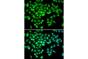 Immunofluorescence analysis of U2OS cells using DDX21 antibody. (DDX21 抗体)