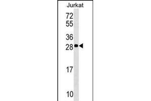 ANP32C Antibody (Center) (ABIN1537820 and ABIN2848975) western blot analysis in Jurkat cell line lysates (35 μg/lane). (ANP32C 抗体  (AA 130-158))