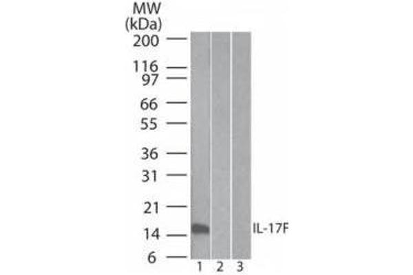 IL17F anticorps