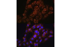 Immunofluorescence analysis of C6 cells using CHCHD2 antibody (ABIN7266448) at dilution of 1:100. (CHCHD2 抗体  (AA 75-145))