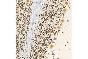 Immunohistochemistry of paraffin embedded rat cerebellum using USP27 (ABIN7076113) at dilution of 1:700 (400x lens) (USP27X 抗体)