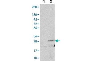 Western blot analysis of Lane 1: Negative control (vector only transfected HEK293T lysate). (ANKRD39 抗体)