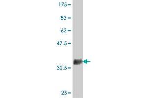 Western Blot detection against Immunogen (37 KDa) . (ZNF598 抗体  (AA 28-126))