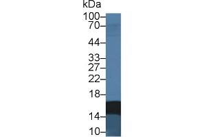 Detection of FABP2 in Rat Small intestine lysate using Monoclonal Antibody to Fatty Acid Binding Protein 2, Intestinal (FABP2)