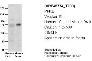 Image no. 2 for anti-Phosphofructokinase, Liver (PFKL) (Middle Region) antibody (ABIN2782359) (PFKL 抗体  (Middle Region))