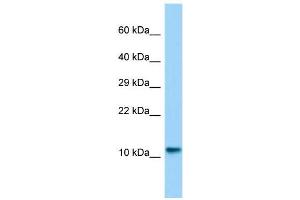 Host:  Rabbit  Target Name:  Lsm10  Sample Type:  Rat Testis lysates  Antibody Dilution:  1. (LSM10 抗体  (N-Term))
