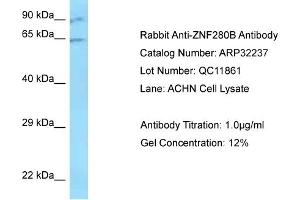 Western Blotting (WB) image for anti-Zinc Finger Protein 280B (ZNF280B) (N-Term) antibody (ABIN2779515) (ZNF280B 抗体  (N-Term))