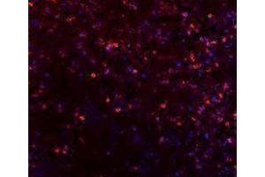 Immunofluorescence (IF) image for anti-Inducible T-Cell Co-Stimulator (ICOS) antibody (Alexa Fluor 647) (ABIN2657721) (ICOS 抗体  (Alexa Fluor 647))