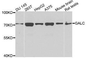 Western Blotting (WB) image for anti-Galactosylceramidase (GALC) (AA 40-300) antibody (ABIN1679950)