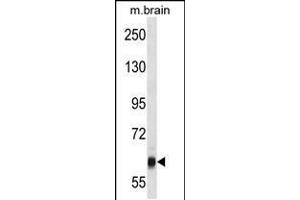Western blot analysis in mouse brain tissue lysates (35ug/lane). (VPS45 抗体  (C-Term))