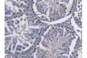Detection of FKBPL in Mouse Testis Tissue using Polyclonal Antibody to FK506 Binding Protein Like Protein (FKBPL) (FKBPL 抗体  (AA 1-347))