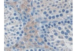 Detection of NXN in Mouse Testis Tissue using Polyclonal Antibody to Nucleoredoxin (NXN) (NXN 抗体  (AA 167-435))