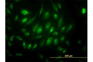 Immunofluorescence of monoclonal antibody to USP33 on HeLa cell. (USP33 抗体  (AA 327-426))