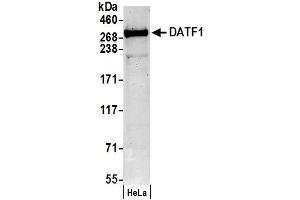 Western Blotting (WB) image for anti-Death Inducer-Obliterator 1 (DIDO1) (AA 300-350) antibody (ABIN7449189)