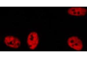 ABIN6272258 staining A549 by IF/ICC. (BRD3 抗体  (C-Term))
