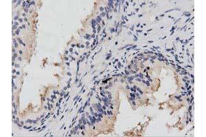 Immunohistochemical staining of paraffin-embedded Human prostate tissue using anti-PTPRE mouse monoclonal antibody. (PTPRE 抗体)