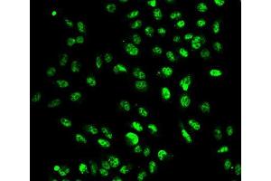 Immunofluorescence analysis of A549 cell using SETD2 antibody. (SETD2 抗体  (AA 803-1103))