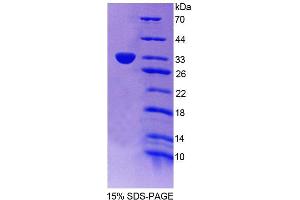 Image no. 1 for Phospholipid Scramblase 5 (PLSCR5) (AA 1-274) protein (T7 tag,His tag) (ABIN6239249)