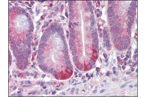 Human Small Intestine (formalin-fixed, paraffin-embedded) stained with RETNLBfollowed by biotinylated anti-goat IgG secondary antibody, alkaline phosphatase-streptavidin and chromogen. (RETNLB 抗体  (Internal Region))
