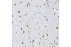 Immunohistochemistry (IHC) image for anti-serine/arginine-Rich Splicing Factor 3 (SRSF3) (AA 1-90) antibody (ABIN6148465)