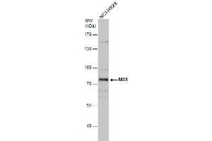 WB Image MX1 antibody detects MX1 protein by western blot analysis. (MX1 抗体  (Center))
