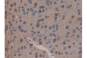 Detection of PLA2R1 in Mouse Brain Tissue using Polyclonal Antibody to Phospholipase A2 Receptor 1 (PLA2R1)
