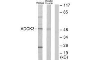 Western blot analysis of extracts from HepG2/mouse muscle cells, using ADCK3 Antibody. (COQ8A 抗体  (AA 301-350))
