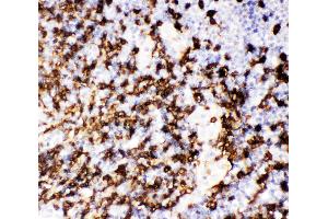 Anti-CD20 Picoband antibody,  IHC(P): Human Tonsil Tissue