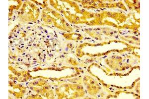 IHC image of ABIN7151735 diluted at 1:400 and staining in paraffin-embedded human kidney tissue performed on a Leica BondTM system.