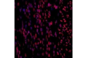 Immunofluorescent analysis of paraformaldehyde-fixed fetal mouse using,Mettl11a (ABIN7074612) at dilution of 1: 1500 (METTL11A 抗体)
