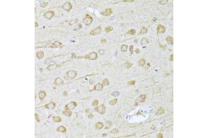 Immunohistochemistry of paraffin-embedded rat brain using FDPS Antibody (ABIN5973369) at dilution of 1/100 (40x lens). (FDPS 抗体)