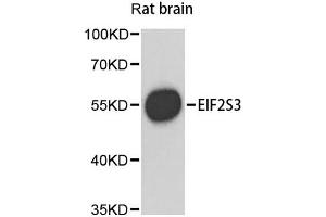 Western blot analysis of extracts of rat brain, using EIF2S3 antibody (ABIN1872488) at 1:1000 dilution. (EIF2S3 抗体)