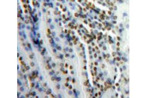 Used in DAB staining on fromalin fixed paraffin-embedded Kidney tissue (SNRPC 抗体  (AA 2-159))