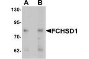 Western blot analysis of FCHSD1 in MCF7 cell lysate with FCHSD1 Antibody  at (A) 0. (FCHSD1 抗体  (C-Term))